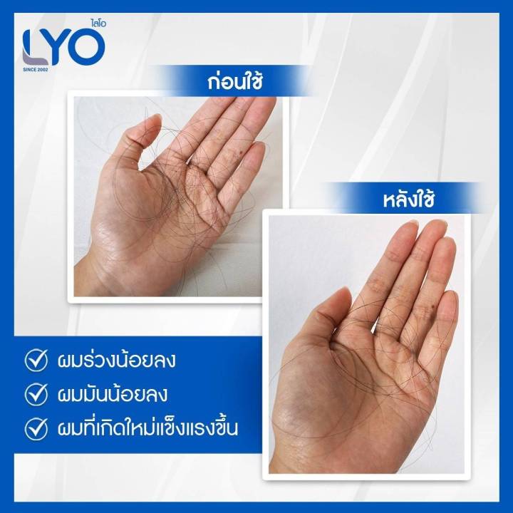 โปรพิเศษ-ซื้อ-1แถม2-lyo-ไลโอแฮร์โทนิค-1-ขวด-แถม-ไลโอแชมพู-1-ขวด-ไลโอครีมนวดผม-1-ขวด-ผลิตภัณฑ์ดูแลผมและหนังศรีษะ