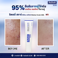 แผลเป็นป้องกันได้ เพียงทาReDelli Scar  9 กรัม ช่วยให้แผลเป็นหายเร็ว นุ่มจางและลดเลือน ลดอาการแดง นูน คัน