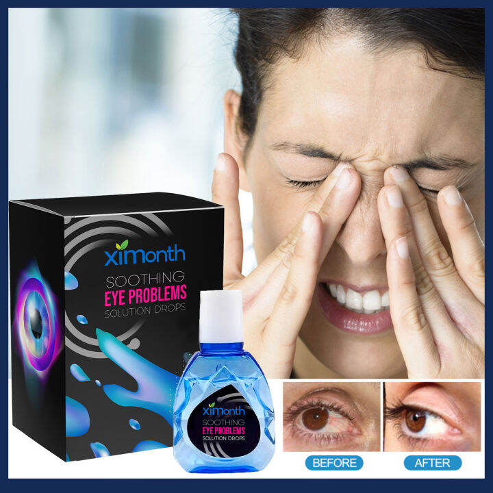 XiMonth Soothing Eye Problems Solution Drops Eye Drops Relieve Redness ...