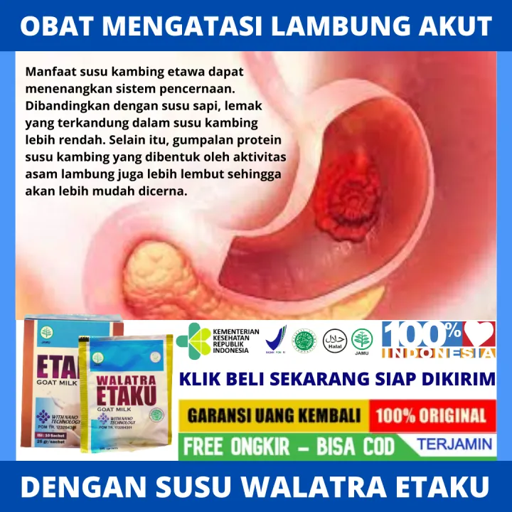 Obat Mengatasi Penyakit Lambung Akut Asam Lambung Naik Sakit Perut