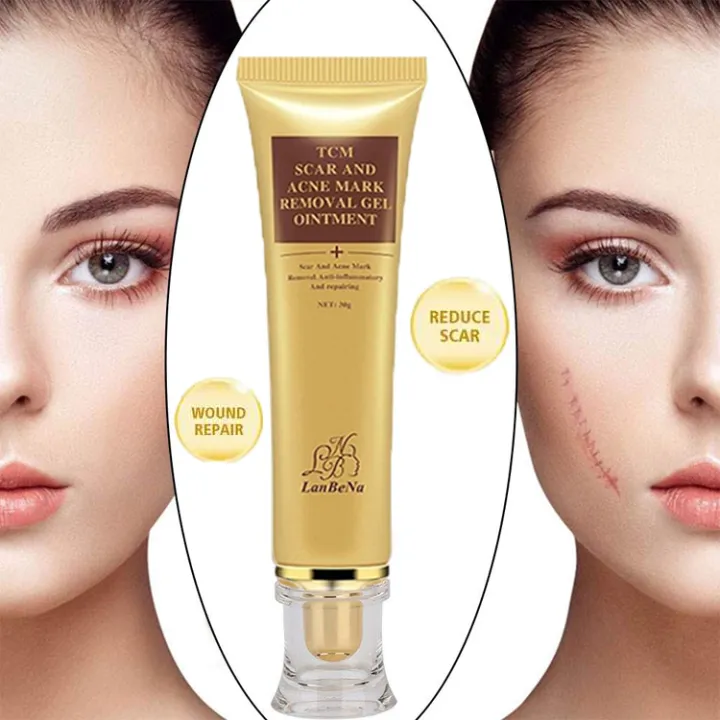 Authentic Original TCM Scar Removal Cream Acne Treatment Acne Scar