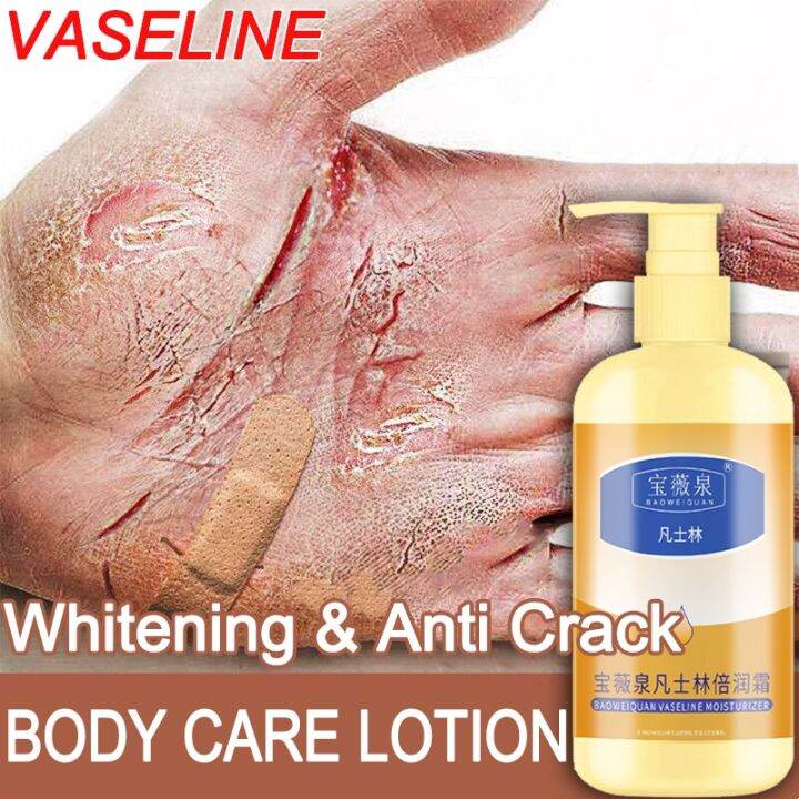 250g Vaseline Moisturizing Cream Whitening Lotion Anti Cracked Dry Hand