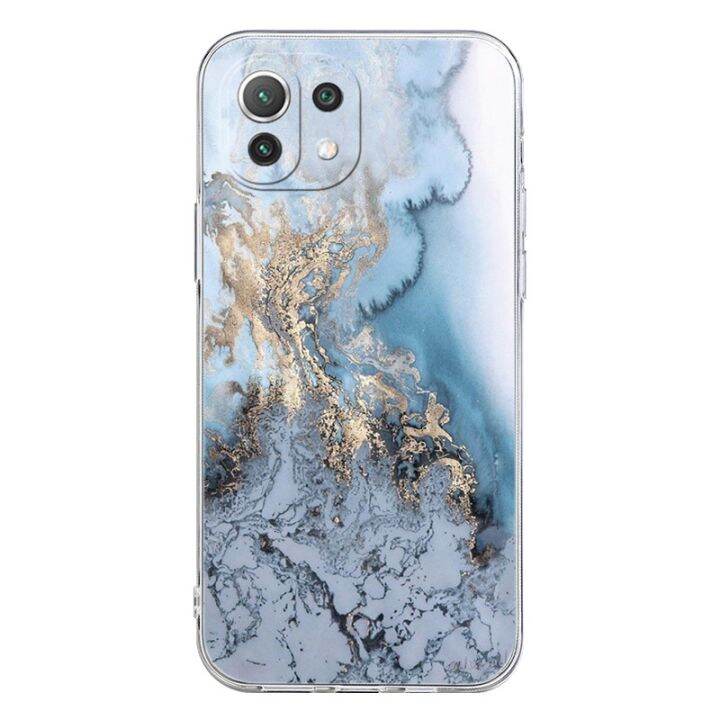 enjoy-electronic-phone-case-for-xiaomi-mi-11-lite-5g-soft-tpu-clear-back-cover-for-xiaomi-mi-11-lite-11lite-mi11-coqueluxury-marble-texture-capa