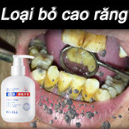 kem đánh răng tẩy ố vàng tẩy trắng răng loại bỏ cao răng hôi miệng 250g