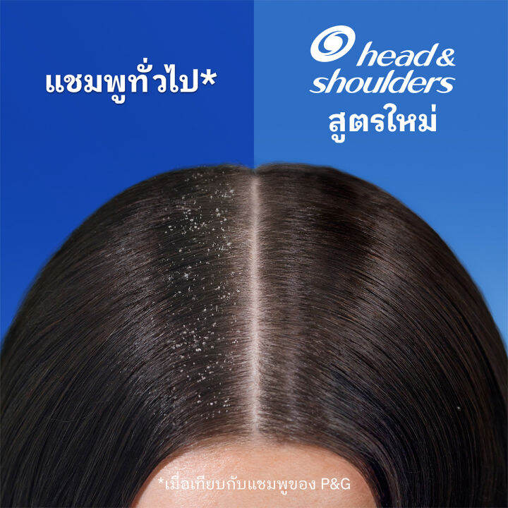 head-and-shoulders-เฮดแอนด์โชว์เดอร์-แชมพูขจัดรังแค-สูตรแอปเปิ้ลเฟรช-370-มล-แพ็คคู่-by-big-c