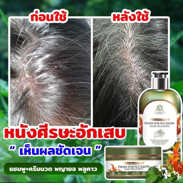 290-anyaa-แชมพู1ขวด-ส่งเร็ว-ของแท้-พญายอ-แชมพู-แก้คัน-ผมร่วง-เชื้อราบนหนังศรีษะ-ของแท้-จากบริษัท