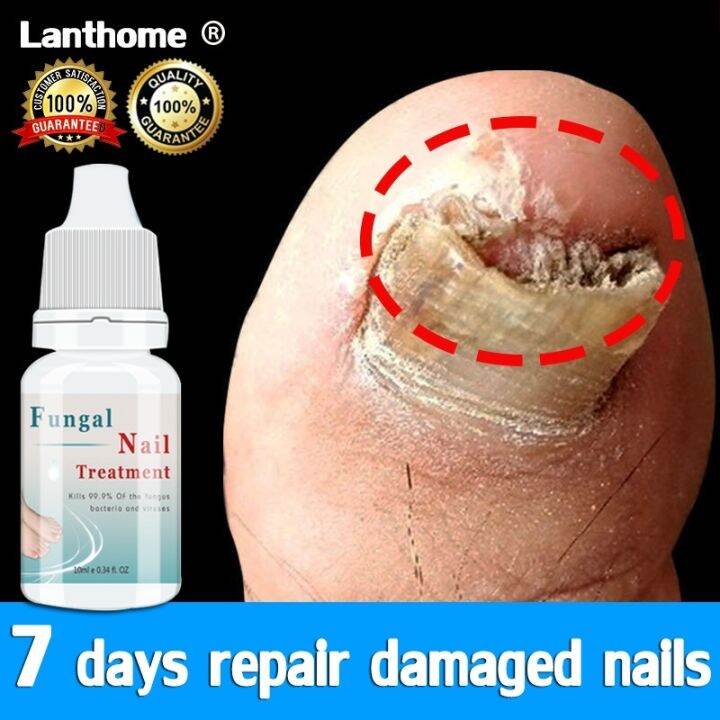 Lanthome Nail Repair Essence Nail Fungus Treatment Remove Onychomycosis