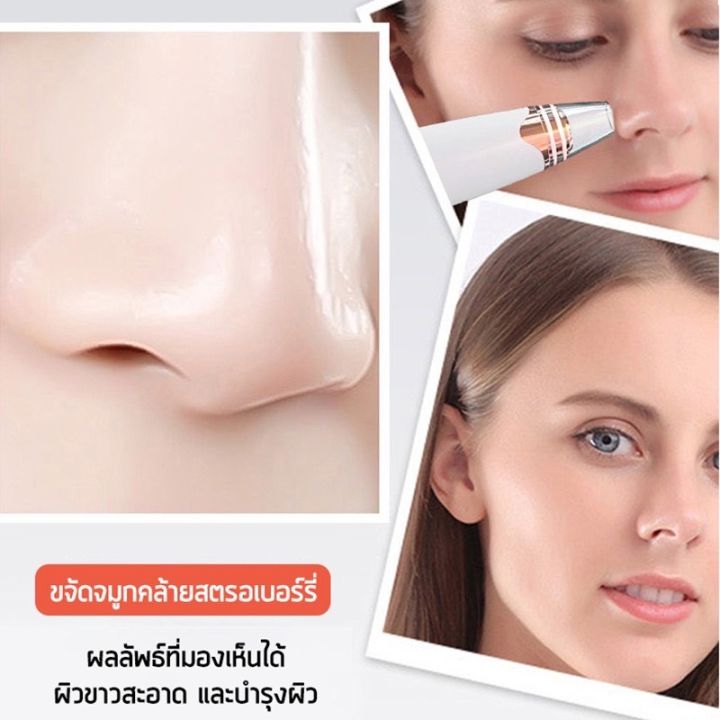 ดูดสิว-เครื่องดูดสิว-ดูดสิวเสี้ยน-สิว-สิวเสี้ยน-สิวและจุดด่างดำ-รูขุมขน-ผิวมัน-ผิวไม่สม่ำเสมอ-ไม่ทำร้ายผิว-ดูดสิวแบบ3d