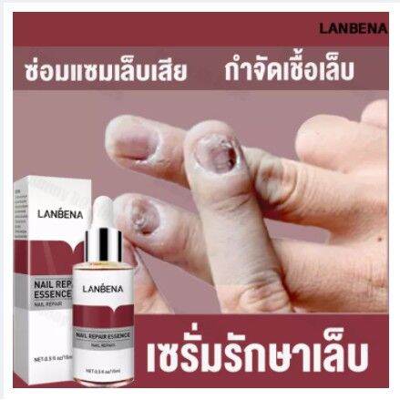 lanbena-เซรั่มเล็บ-บำรุงเล็บ-เล็บขบ-เชื้อรา-ซ่อมแซมเล็บแตก-เล็บเปราะ-เล็บหนา-15ml-แถมฟรี-ตะไบเล็บ