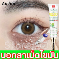 Aichun มาร์คใต้ตา 30ml ครีมบำรุงใต้ตา ครีมกำจัดตุ่มไขมัน สมัครสัมผัสของความหมองคล้ำให้หายไป (ครีมใต้ตา เซรั่มทาถุงใต้ตา ครีมแก้ขอบตาดำ ครีมทารอบดวงตา อายครีม ครีมทารอบดวงตา เม็ดไขมัน ​ครีมลบ ให้ความชุ่มชื่น ครีมทาใต้ตาดำ ครีมบำรุงรอบตา eye cream）