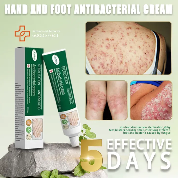 atoderma cream original for skin problem gamot sa kati kati sa balat ...