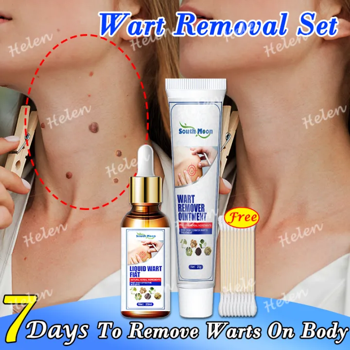🔥Send Cotton Swabs🔥Wart Removal Set Painless And Gentle Wart Removal