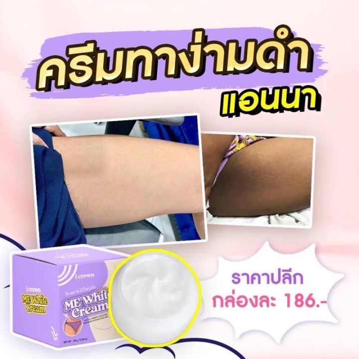 พร้อมส่ง-ครีมทาง่ามขา-ครีมแอนนา-ข้อศอกด้าน-เข่าดำ-7-วันเห็นผลชัดเจน-ลอกผิวขาว-แก้ปัญหาขาหนีบดำได้จริง