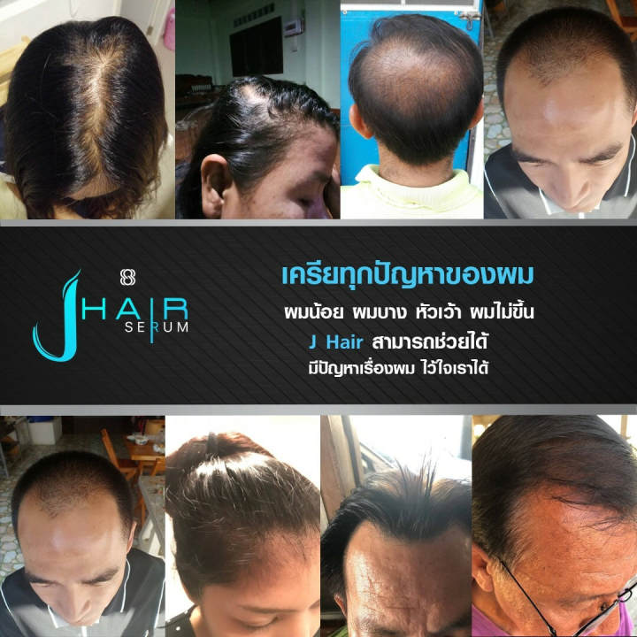 j-hair-serum-เจ-แฮร์-เซรั่ม-30-ml-เซรั่มบำรุงเส้นผม-หนวด-เครา