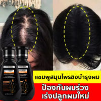 PEIMEI แชมพูสระผมแก้ผมร่วง สูตรแก้ปัญหาผมร่วง แชมพูขิงเพียว 250ml ช่วยผมงอกใหม่ แชมพูสมุนไพร แชมพูขจัดรังแค แชมพูแก้ผมร่วง แชมพูปลูกผม