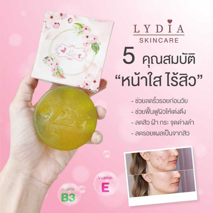 สบู่ลิเดีย-lydia-soap-สบู่สมุนไพรหน้าใสลิเดีย