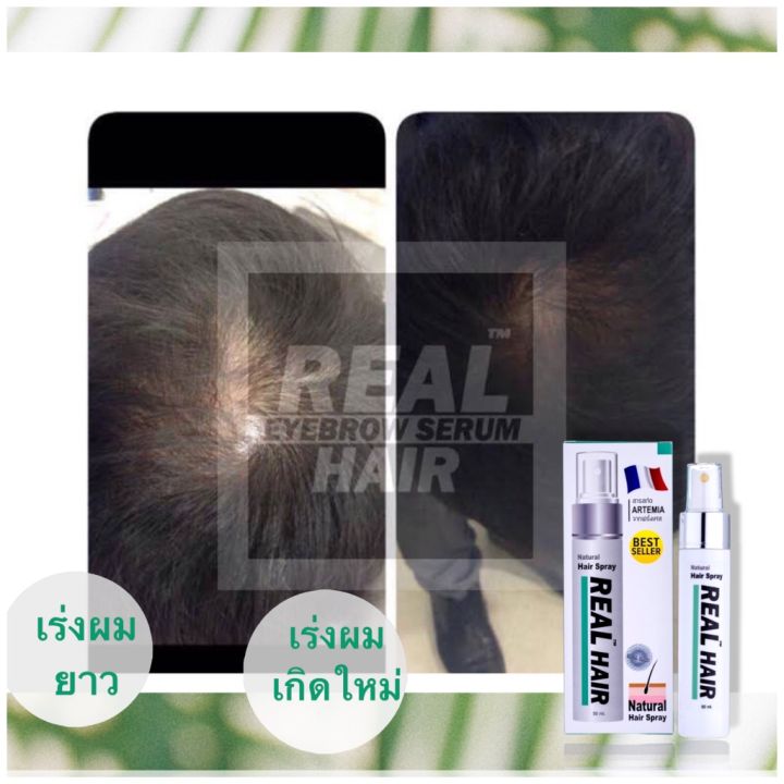 real-hair-สเปรย์ปลูกผม-เร่งผมยาว-50-ml