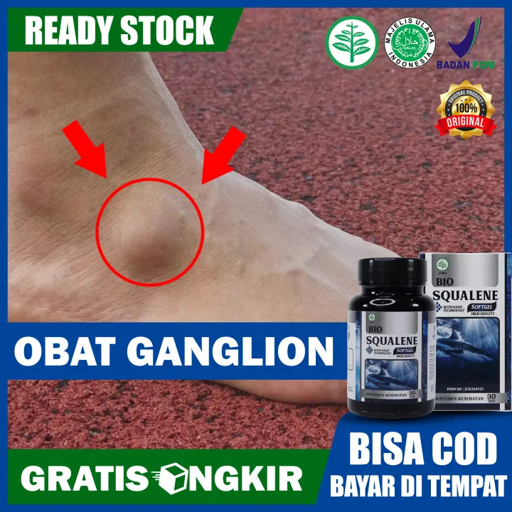 Bergaransi RESMI [BISA COD] - Obat Ganglion, Kista Ganglion, Obat ...