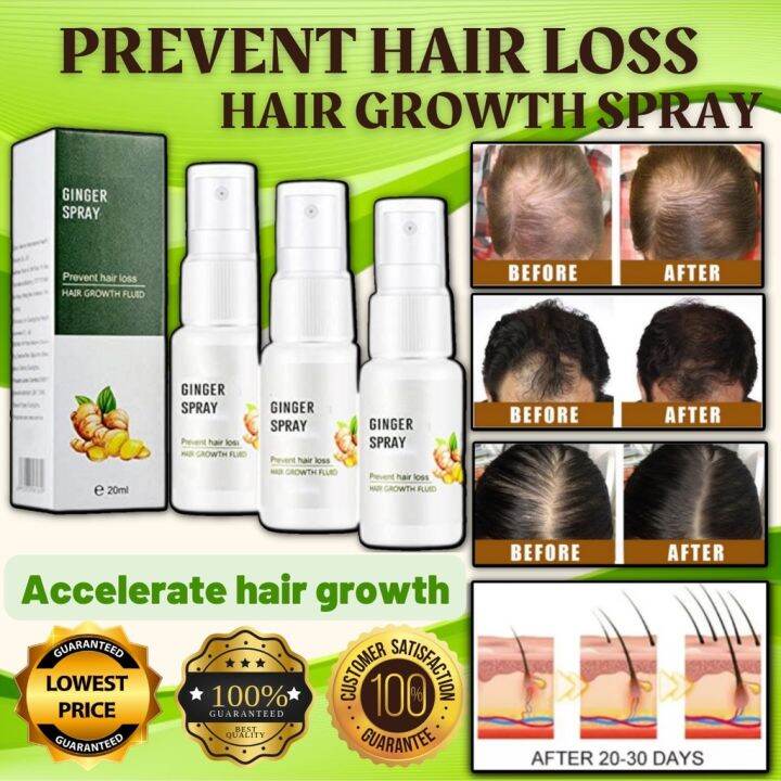 Fast Hair growth spray prevent hair loss for men and women hair care ...