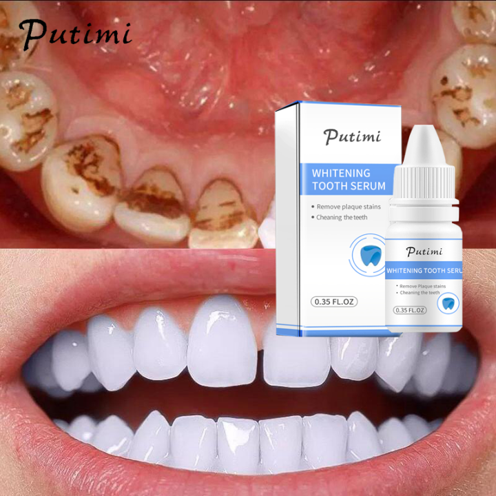 PUTIMI Teeth Whitening Serum Gel Effective Stains Removal Cleaning