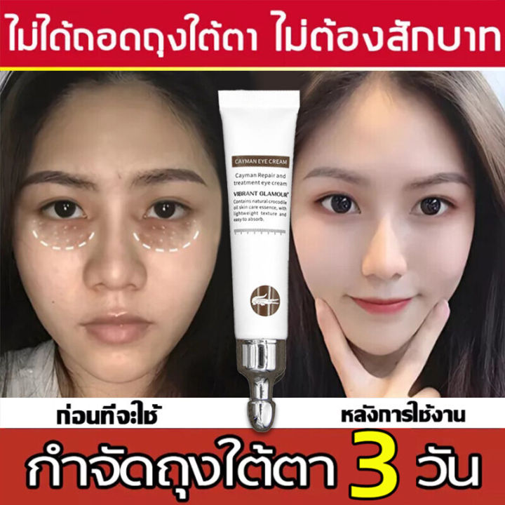 ของแท้-100-ครีมลดถุงใต้ตา-เมจิกอายครีม-ครีมถุงใต้ตา-ครีมทาถุงใต้ตา-ถุงใต้ตาบวม-ครีมทารอบดวงตา-กระชับ-ยกกระชับ-อายครีมลดใต้ตา-eye-cream