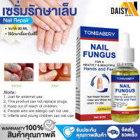 Nail Fungus น้ำยาบำรุงเล็บ เซรั่มรักษาเล็บ Nail Repair บำรุงเล็บ เซรั่มบำรุงเล็บ 30ml ซ่อมแซมเล็บเสีย รักษาเชื้อราเล็บ ซ่อมแซมเล็บแตก daisyshopz