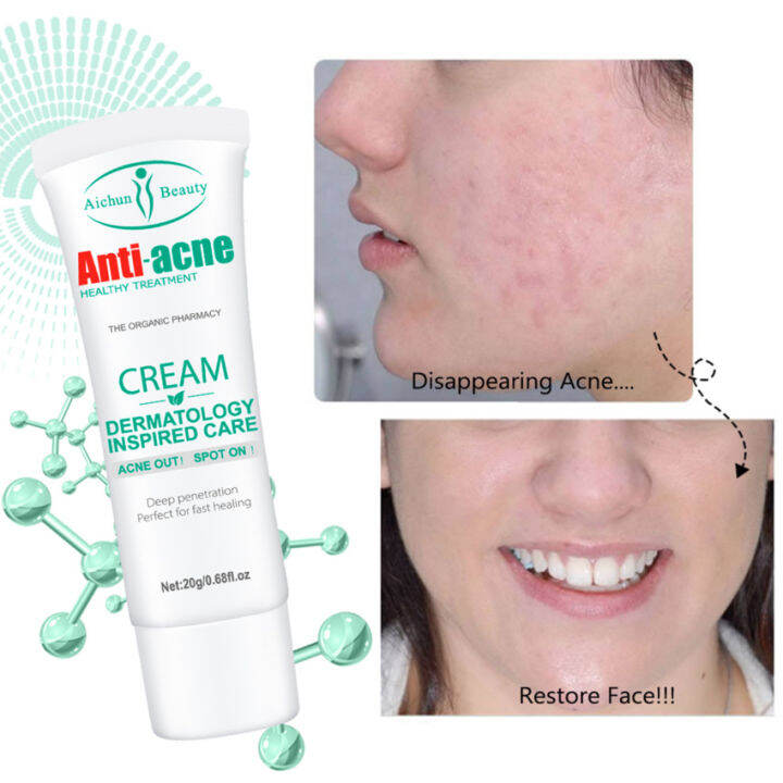 Salicylic Acid Face Cream Moisturizing And Brightening Skin Shrink
