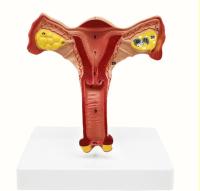 Uterine Anatomy Female Reproductive System Planning Model Teaching Model จัดส่งฟรี