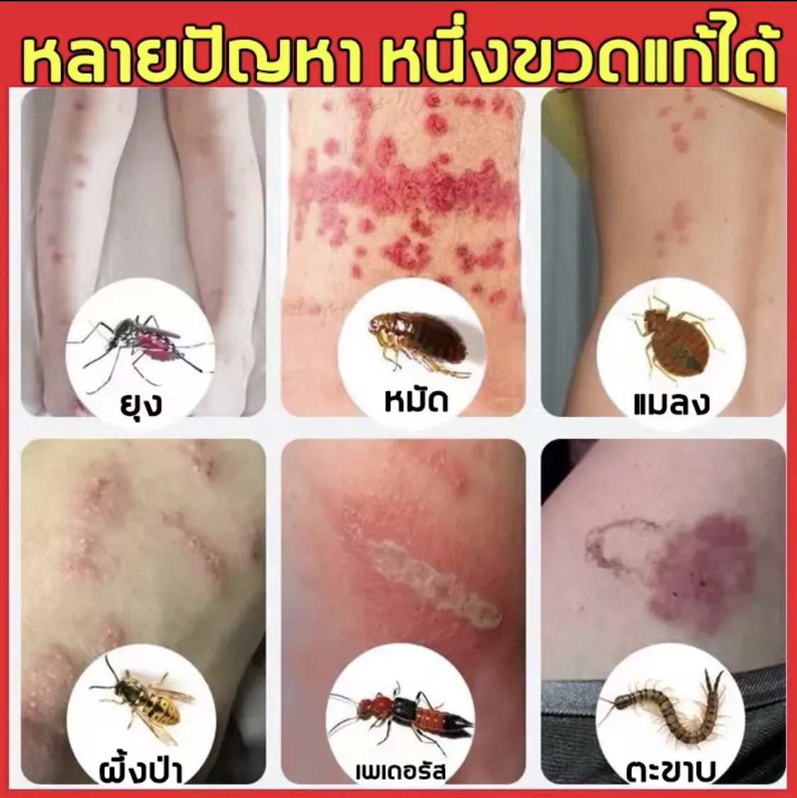ลูกกลิ้งไล่ยุง ครีมทาแก้คัน หายคันรวดเร็ว ลบบวม ลบแดง ไม่ทิ้งรอยดำ สำหรับเด็กและผิวแพ้ง่าย กลิ่นละมุน ยาแก้คัน จากยุงกัด มดกัด แมลง ฯลฯ ครีมทาหลังยุงกัด ครีมทายุงกัดสำหรับเด็กแรกเกิด โลชั่นกันยุง กันยุง ป้องกันยุง ครีมลดรอยดำเด็ก | Lazada.co.th ลูกกลิ้งไล่ยุง ครีมทาแก้คัน หายคันรวดเร็ว ลบบวม ลบแดง ไม่ทิ้งรอยดำ สำหรับเด็กและผิวแพ้ง่าย กลิ่นละมุน ยาแก้คัน จากยุงกัด มดกัด แมลง ฯลฯ ครีมทาหลังยุงกัด ครีมทายุงกัดสำหรับเด็กแรกเกิด โลชั่นกันยุง กันยุง ป้องกันยุง ครีมลดรอยดำเด็ก | Lazada.Co.Th