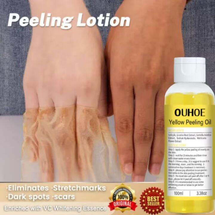 100ML OUHOE Yellow Peeling Oil Effective Facial Oil body oil For