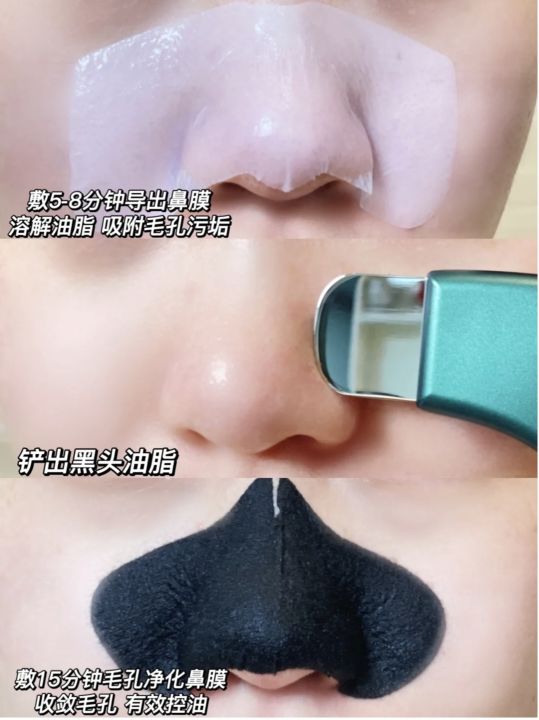 blackheads-one-stop-bai-cuisi-nose-sticks-to-remove-blackheads-box-export-liquid-shrink-pores-close-acne-clean