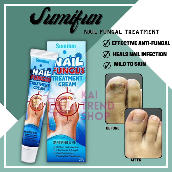 SUMIFUN Nail Care for cracked and rough nails, nursing care of ...