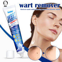 EBO หูด Remover ครีมกำจัดหูดผิวแท็ก Remover สมุนไพรสารสกัดจากหูด Remover ครีมหูดรักษาผิวเครื่องหมาย Remover ครีมต้านเชื้อแบคทีเรียเท้าหูดครีม