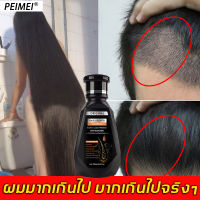 【แก้ปัญหาเส้นผม?】PEIMEI แชมพูแก้ผมร่วง แชมพูขิง ยาสระผมแก้ร่วง 250ml ซ่อมแซมผมเสีย （แชมพูปลูกผม แชมพูสระผม แชมพูขิงเพียว แชมพูผมดก）