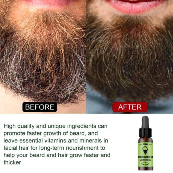 cc-beard-baard-growth-men-homme-barbe-crescer-para-barba-crecer-rapido-hombre-baardolie-accessories