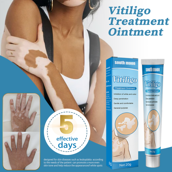 Atoderma Cream Vitiligo Treatment Cream Vitiligo Remover Vitiligo Cream Atoderma Cream Vitiligo Treatment Cream Vitiligo Remover Vitiligo Cream