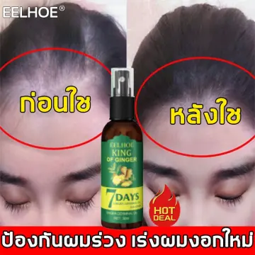 น้ำยาผมยาวน้ำยา ราคาถูก ซื้อออนไลน์ที่ - ก.ค. 2023 | Lazada.Co.Th