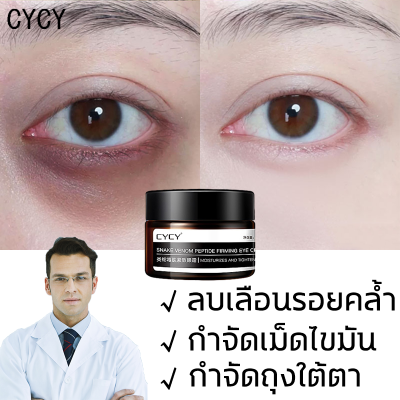 CYCY อายครีม อายครีมบำรุงตา ครีมบำรุงรอบตา ครีมทารอบดวงตา ลดใต้ตาดำ ถุงใต้ตา ครีมบำรุงรอบดวงตาต่อต้านริ้วรอย กระชับรอยตีนกา กักเก็บน้ำ ให้ความชุ่มชื้น ลดเลือนริ้วรอยรอบดวงตา ครีมทาใต้ตาดำ ครีมบำรุงใต้ตา บำรุงรอบดวงตาบำรุง Eye Creams 30g