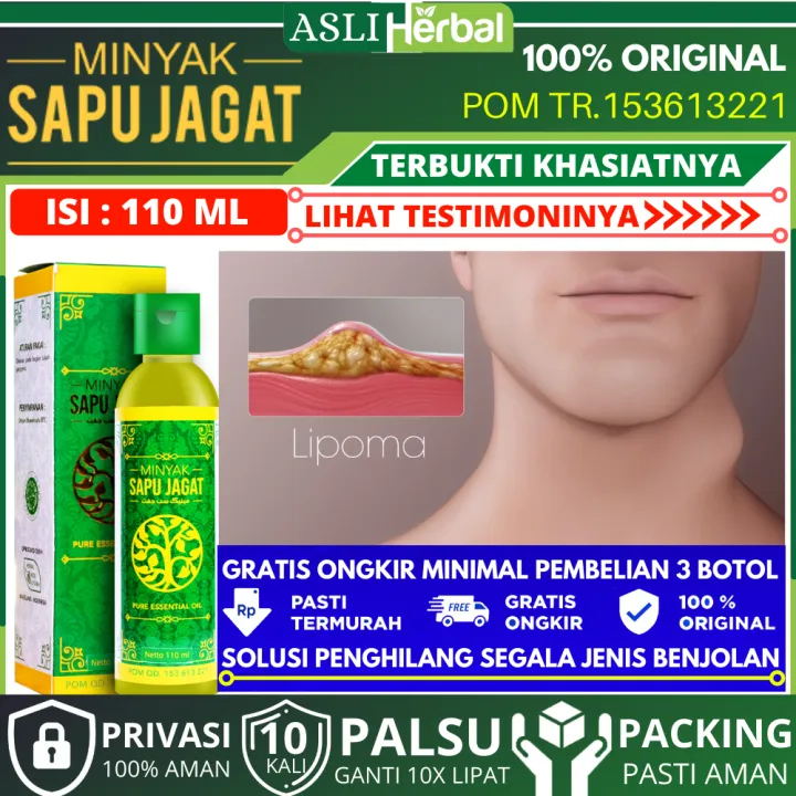 Minyak Sapu Jagat Minyak Oles Balur Pijat Minyak Obat Benjolan Mengobati Semua Benjolan Obat Kelenjar Getah