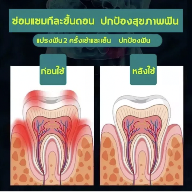 ยาสีฟัน-สูตร-ยาสีฟันเอนไซม์-ฟันขาว-ขจัดคราบหินปูน-ลดกลิ่นปาก-ดีเยี่ยม