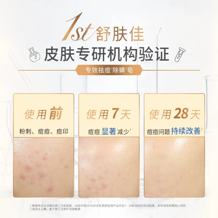 Safeguard Soap Acarus Killing Acne Removing Refreshing White Tea