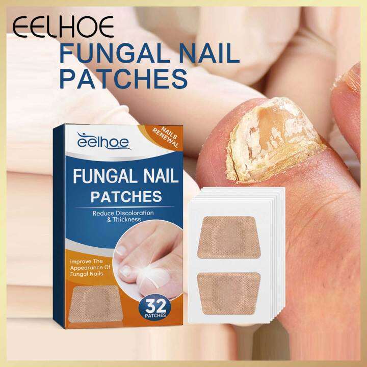 Eelhoe Fungal Nail Patches Anti Infection Correction Sticker Ingrown