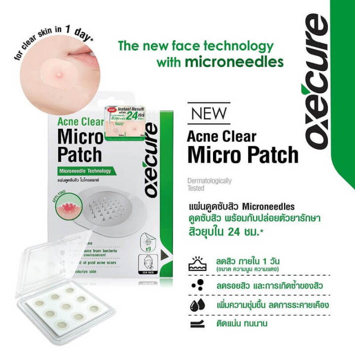 oxecure-acne-clear-micro-patch-แผ่นดูดซับสิว-พร้อมด้วย-เทคโนโลยี-microneedle