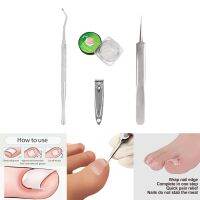 【CW】 Ingrown Toenail Correction Tools Set Wrap  Step  Nails Do Not Stab the Meat