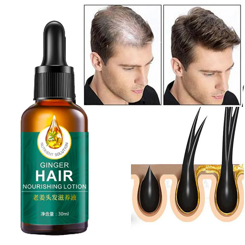 30ml】Ginger hair growth oil hair growth beard growth serum Hair growth nutrient solution hair loss repair hair follicle promote hair growth balance oil improve frizz hair smooth protection liquid 30ml】Ginger hair growth oil hair growth beard growth serum Hair growth nutrient solution hair loss repair hair follicle promote hair growth balance oil improve frizz hair smooth protection liquid