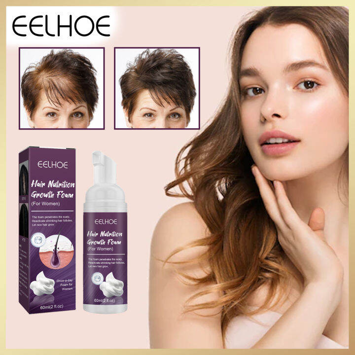 Eelhoe Minoxidil Foam Hair Regrowth Spray Anti Hair Loss Treatment