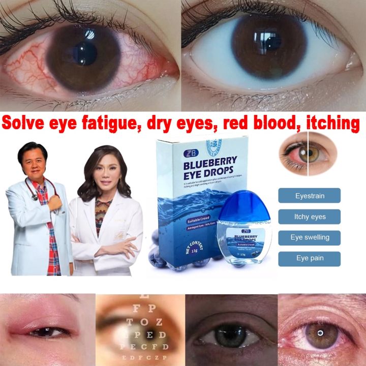 ORIGINAL Blueberry Eye Drop Relieves Red Eyes Blurred Vision