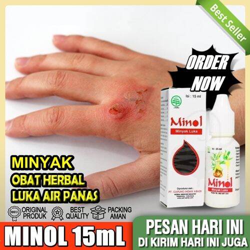 PROMO Obat Luka Bakar Kena Minyak Goreng Luka Tersiram Air Panas Obat ...