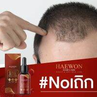 หัวเถิก ผมร่วง หัวหงอกก่อนวัย Heawon hair care เซรั่มผม 490.- (ส่งฟรี)