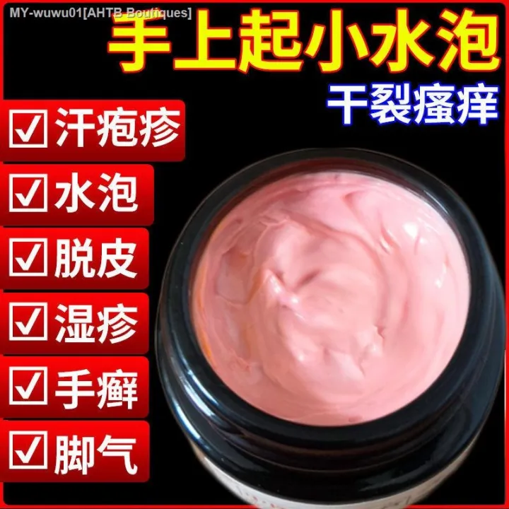 Sweat herpes blisters on hands and feet Lazada